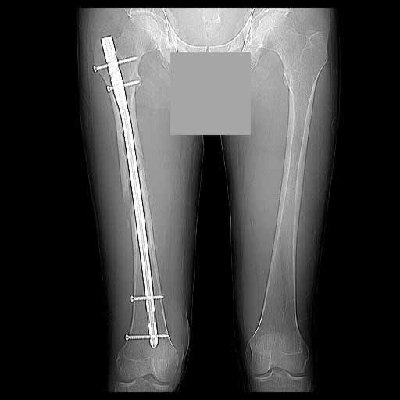leg1.jpg